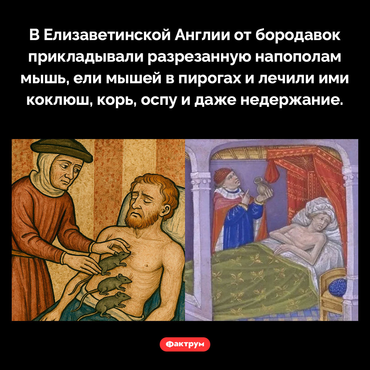 Лечение мышами. В Елизаветинской Англии от бородавок прикладывали разрезанную напополам мышь, ели мышей в пирогах и лечили ими коклюш, корь, оспу и даже недержание.