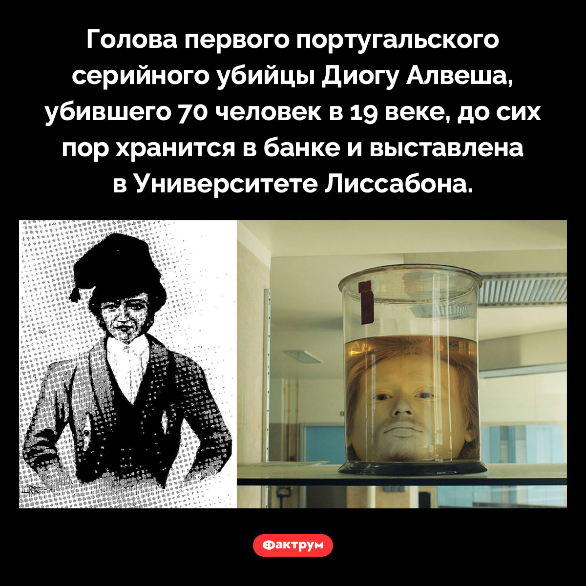 Первый португальский серийный убийца. Голова первого португальского серийного убийцы Диогу Алвеша, убившего 70 человек в 19 веке, до сих пор хранится в банке и выставлена в Университете Лиссабона.
