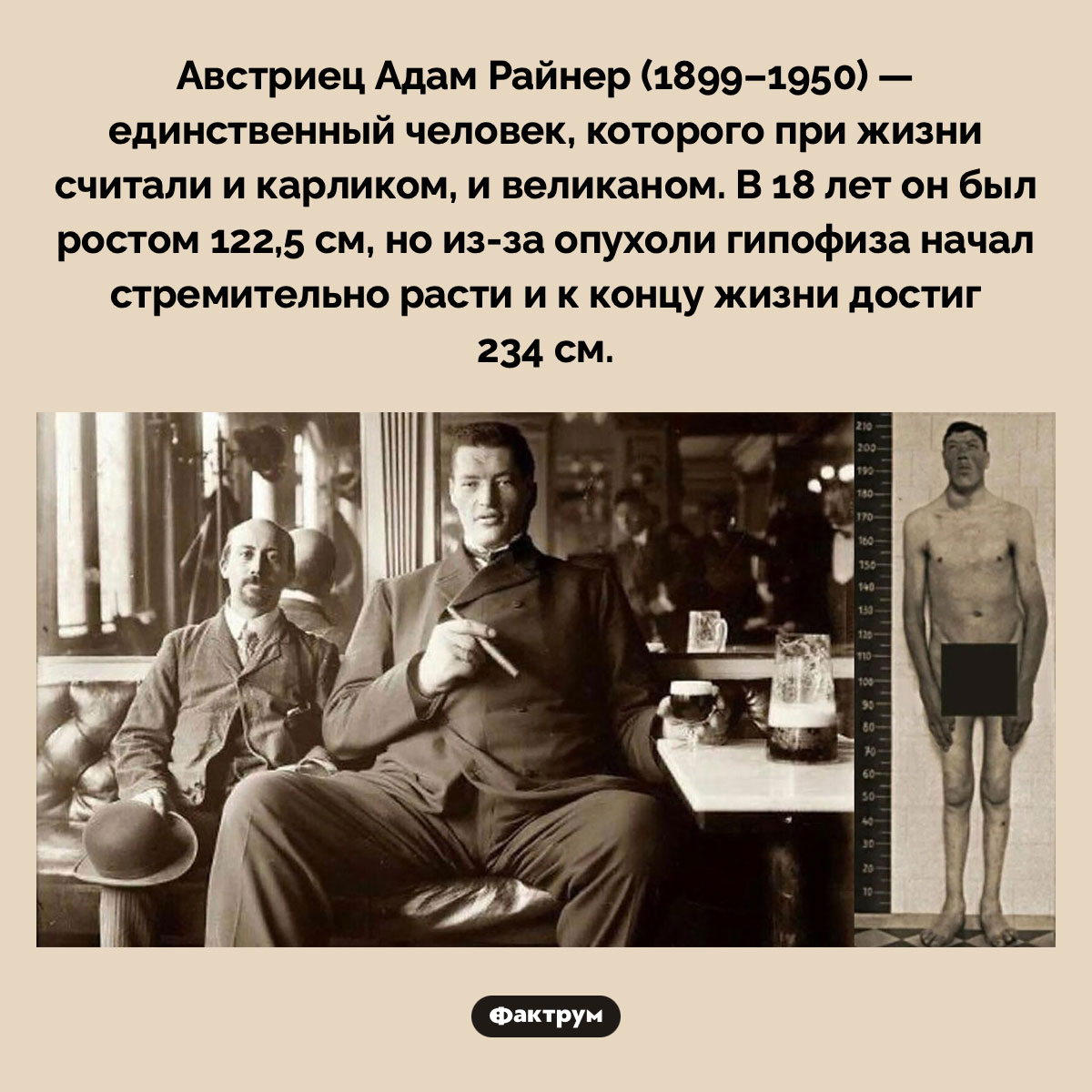 Карлик и гигант Адам Райнер. Австриец Адам Райнер (1899–1950) — единственный человек, которого при жизни считали и карликом, и великаном. В 18 лет он был ростом 122,5 см, но из-за опухоли гипофиза начал стремительно расти и к концу жизни достиг 234 см.