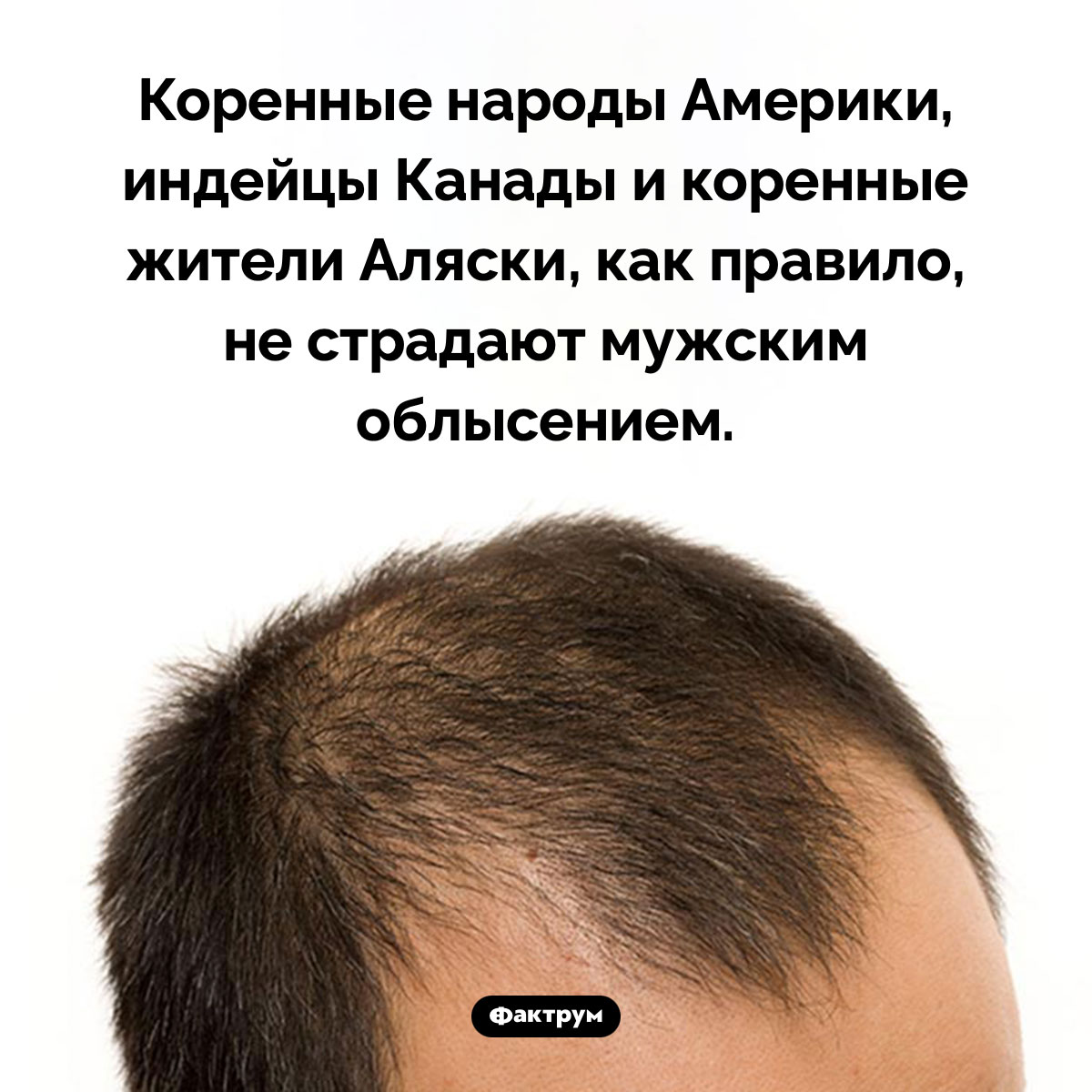 Кто не страдает мужским облысением. Коренные народы Америки, индейцы Канады и коренные жители Аляски, как правило, не страдают мужским облысением.