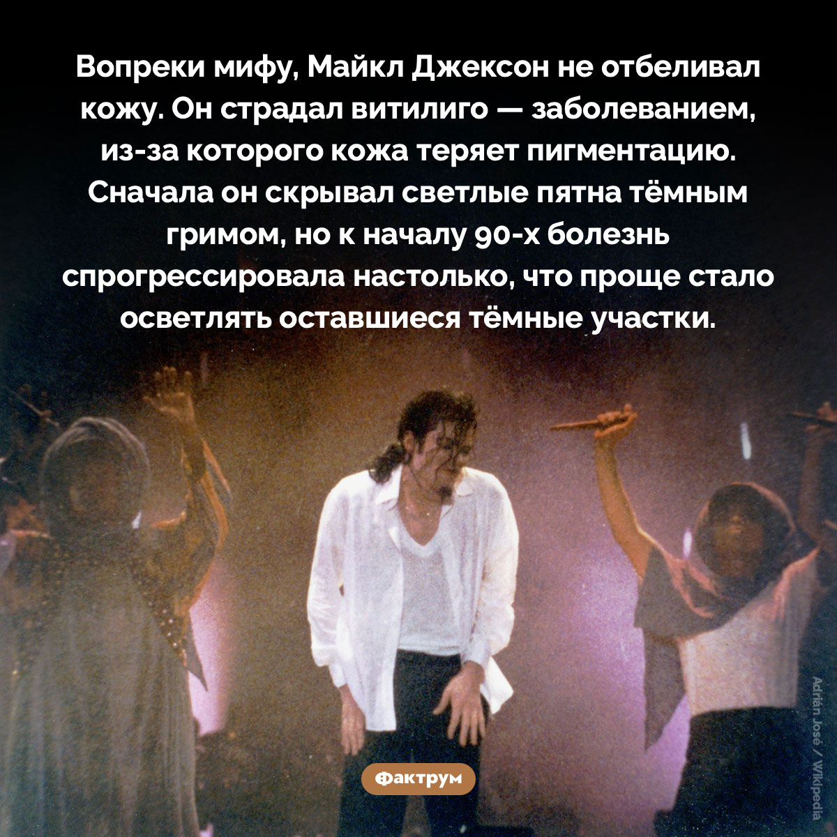 Майкл Джексон не отбеливал кожу. Вопреки мифу, Майкл Джексон не отбеливал кожу. Он страдал витилиго — заболеванием, из-за которого кожа теряет пигментацию. Сначала он скрывал светлые пятна тёмным гримом, но к началу 90-х болезнь спрогрессировала настолько, что проще стало осветлять оставшиеся тёмные участки.