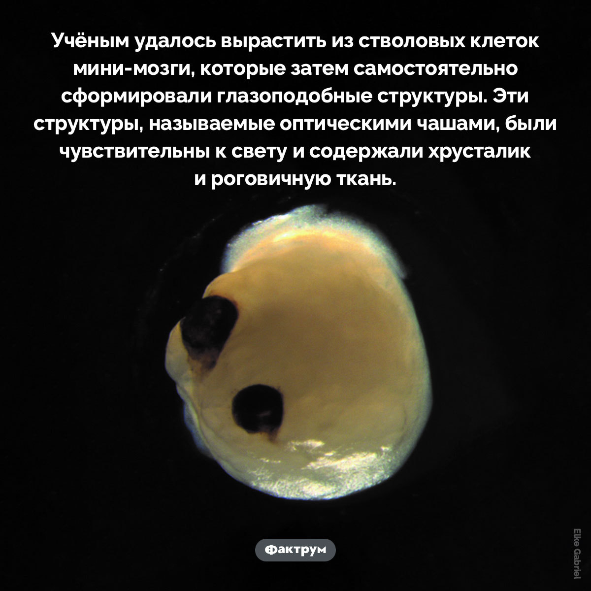 Мини-мозги с глазами. Учёным удалось вырастить из стволовых клеток мини-мозги, которые затем самостоятельно сформировали глазоподобные структуры. Эти структуры, называемые оптическими чашами, были чувствительны к свету и содержали хрусталик и роговичную ткань.