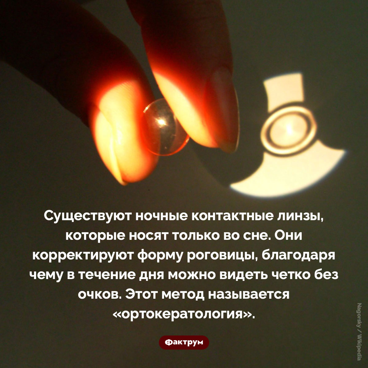 Ночные контактные линзы. Существуют ночные контактные линзы, которые носят только во сне. Они корректируют форму роговицы, благодаря чему в течение дня можно видеть четко без очков. Этот метод называется «ортокератология».