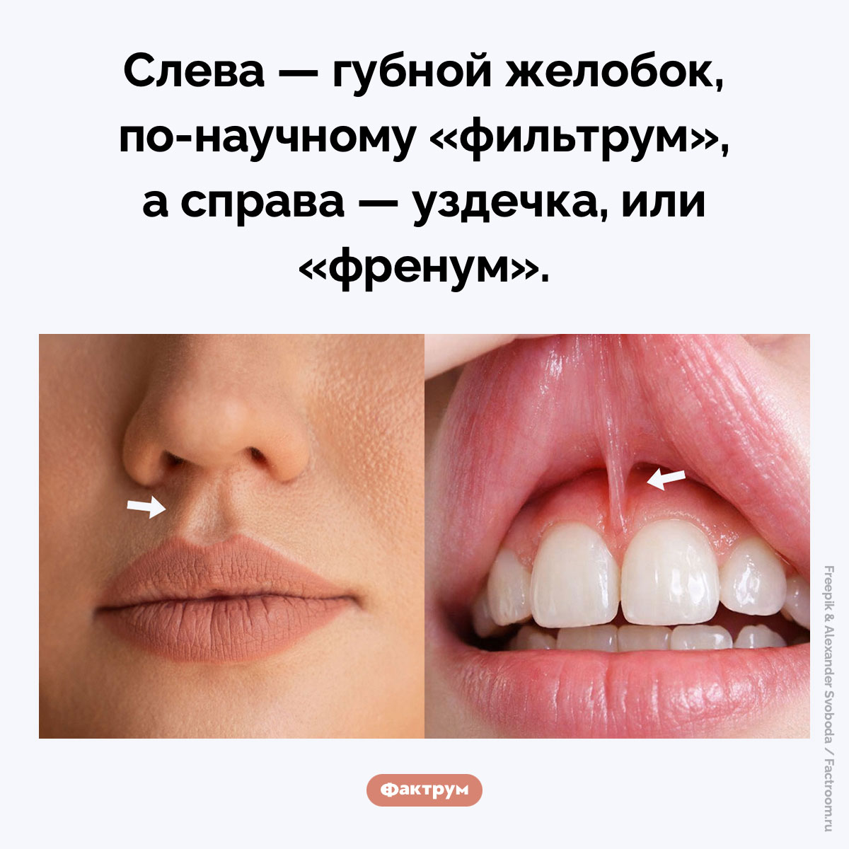 «Фильтрум» и «френум». Слева — губной желобок, по-научному «фильтрум», а справа — уздечка, или «френум».