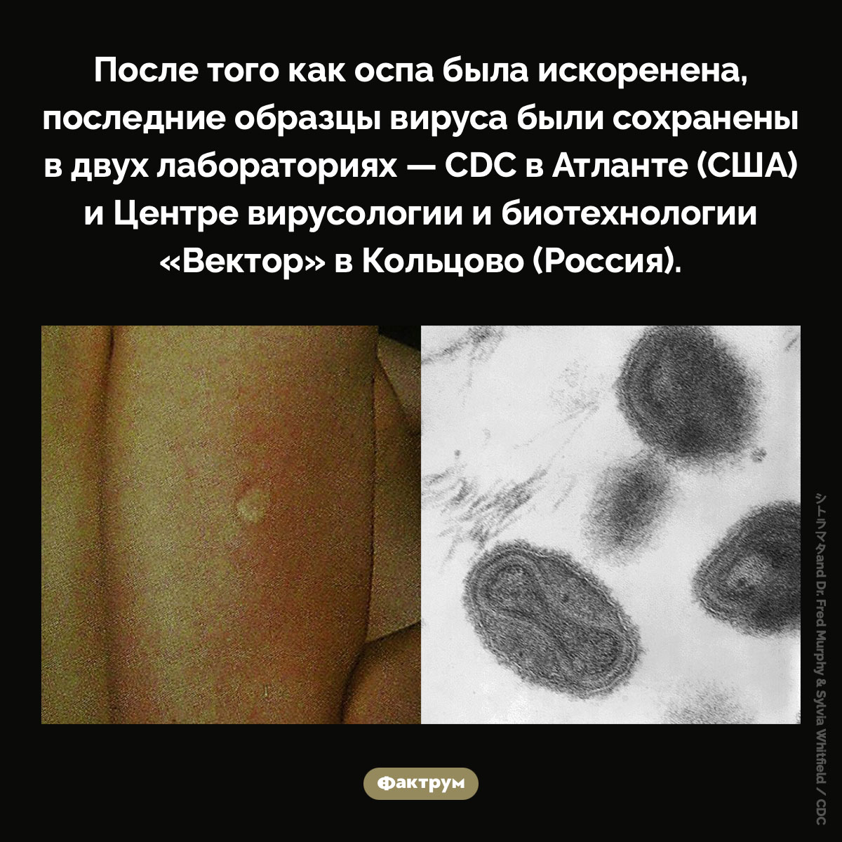 Где хранится вирус оспы. После того как оспа была искоренена, последние образцы вируса были сохранены в двух лабораториях — CDC в Атланте (США) и Центре вирусологии и биотехнологии «Вектор» в Кольцово (Россия).