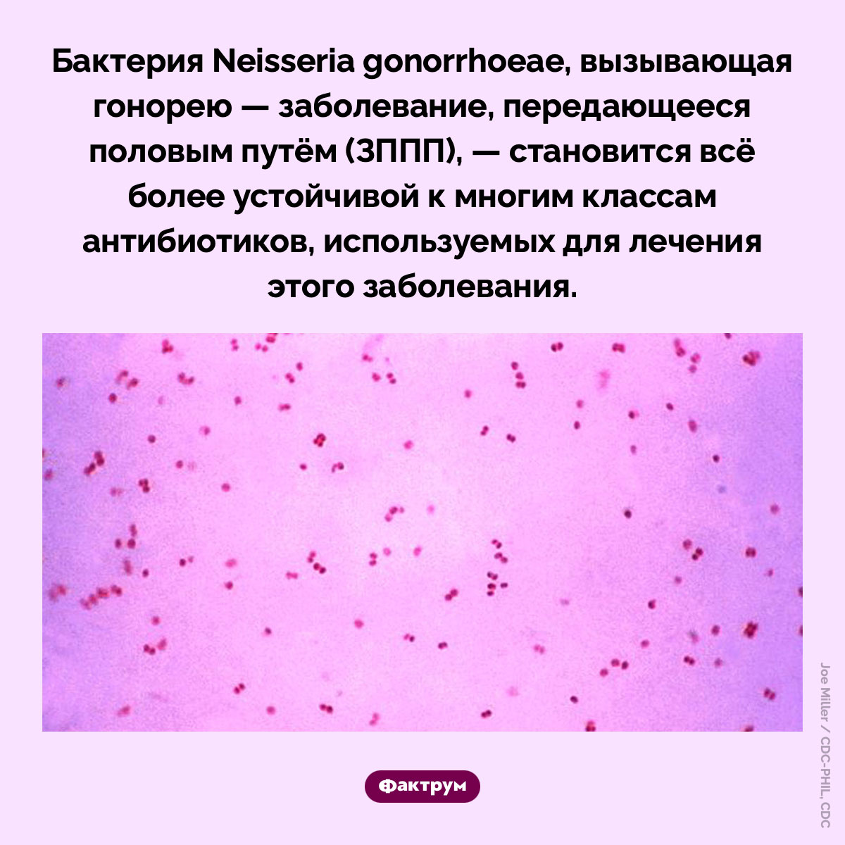 Гонорея становится более устойчивой к антибиотикам. Бактерия Neisseria gonorrhoeae, вызывающая гонорею — заболевание, передающееся половым путём (ЗППП), — становится всё более устойчивой к многим классам антибиотиков, используемых для лечения этого заболевания.
