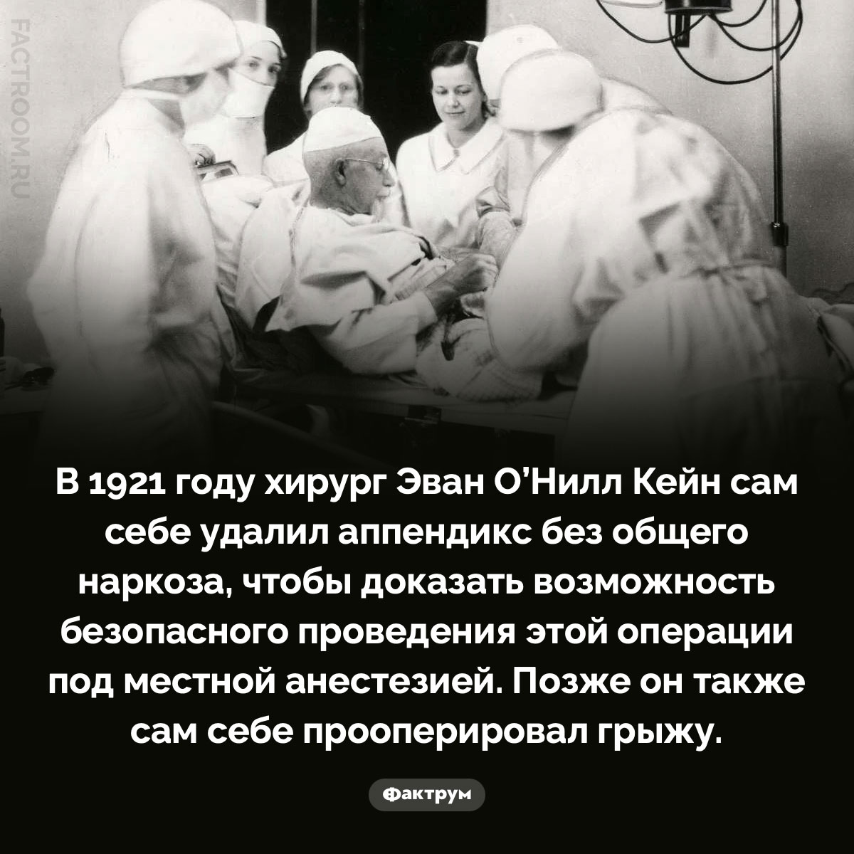 Зачем хирург Эван О’Нилл Кейн сам себе удалил аппендикс. В 1921 году хирург Эван О’Нилл Кейн сам себе удалил аппендикс без общего наркоза, чтобы доказать возможность безопасного проведения этой операции под местной анестезией. Позже он также сам себе прооперировал грыжу.