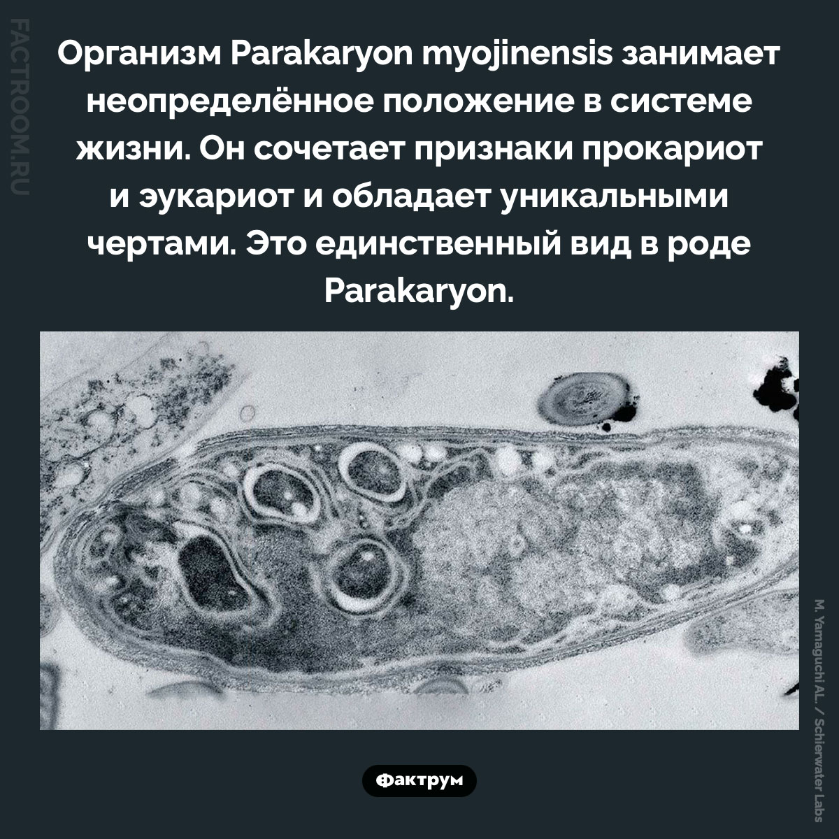 Parakaryon myojinensis. Организм Parakaryon myojinensis занимает неопределённое положение в системе жизни. Он сочетает признаки прокариот и эукариот и обладает уникальными чертами. Это единственный вид в роде Parakaryon.