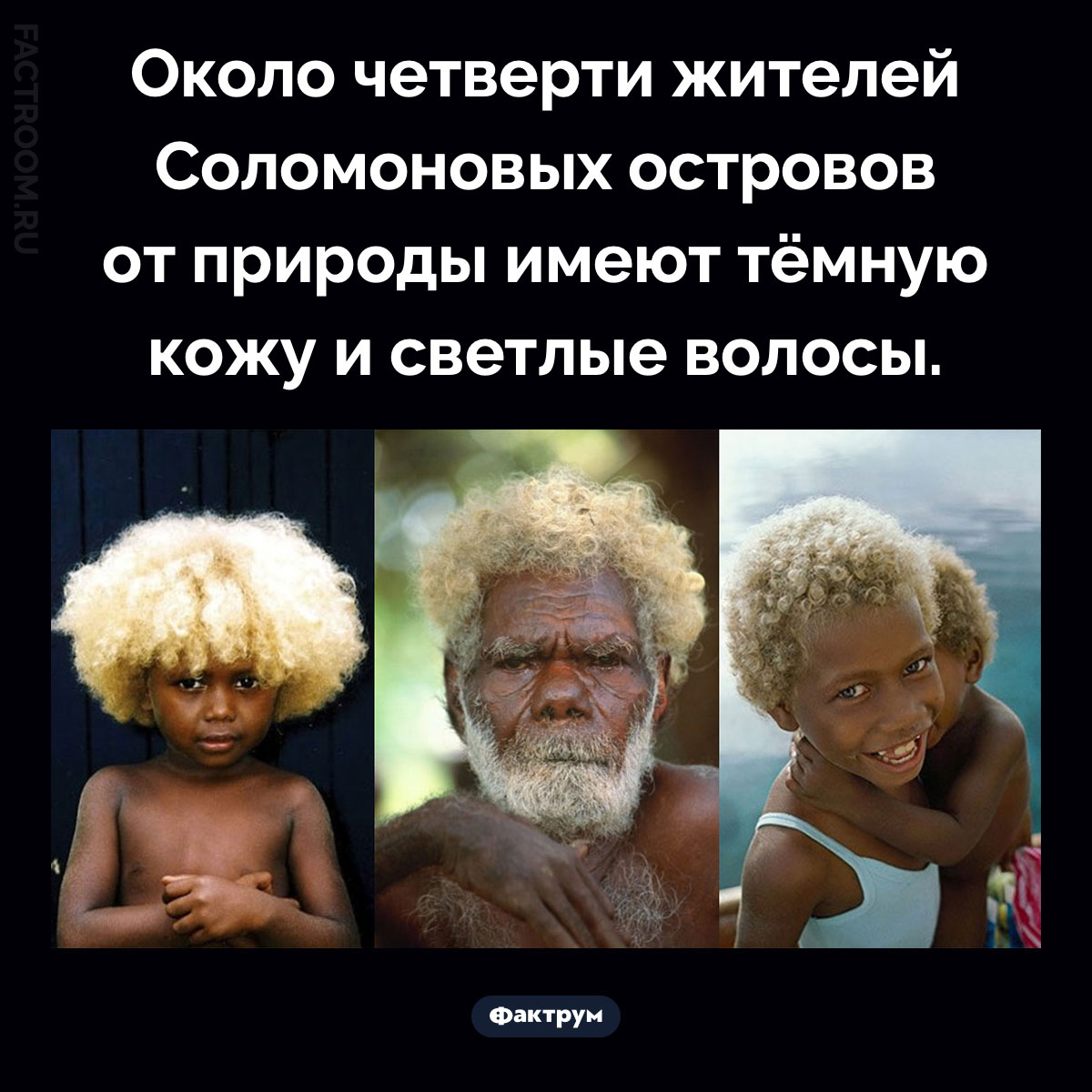 Чернокожие блондины Соломоновых островов. Около четверти жителей Соломоновых островов от природы имеют тёмную кожу и светлые волосы.