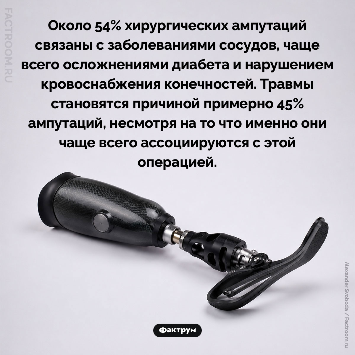 Большинство хирургических ампутаций связаны с заболеваниями сосудов. Около 54% хирургических ампутаций связаны с заболеваниями сосудов, чаще всего осложнениями диабета и нарушением кровоснабжения конечностей. Травмы становятся причиной примерно 45% ампутаций, несмотря на то что именно они чаще всего ассоциируются с этой операцией.